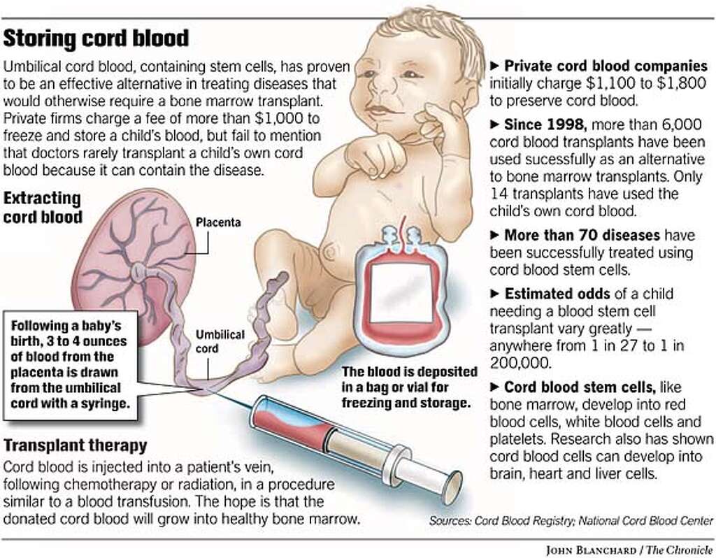 What are the benefits of banking your baby's cord blood?