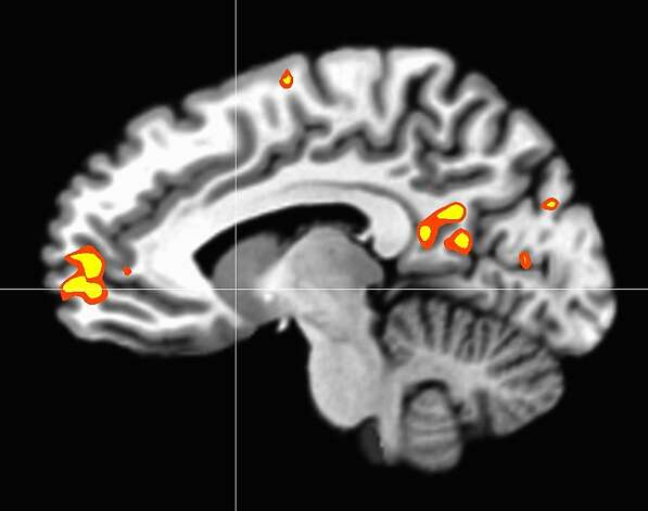 A brain scan of a monk actively extending compassion shows activity in the medial prefrontal cortex, an area of the brain associated with reward processing. Photo: SPAN Lab, Stanford University / SF